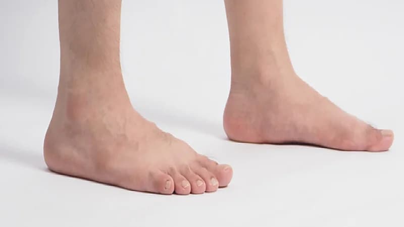 بالفيديو.. استشاري قدم وكاحل: مليون مواطن مهدد بالبتر في المملكة