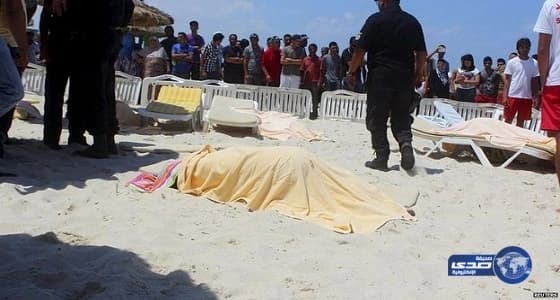 فريق طبي ينجح في زراعة قوقعة لتوأم بالجوف