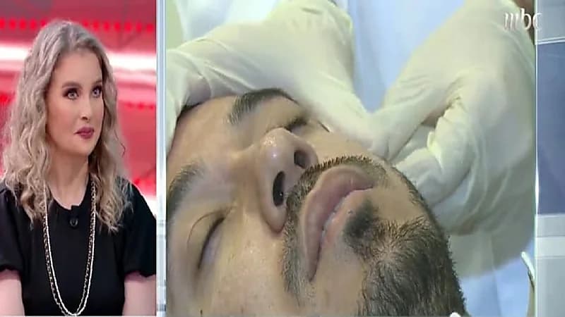 بالفيديو.. طبيبة تجميل توضح لماذا يقبل الرجال على الإجراءات التجميلية؟