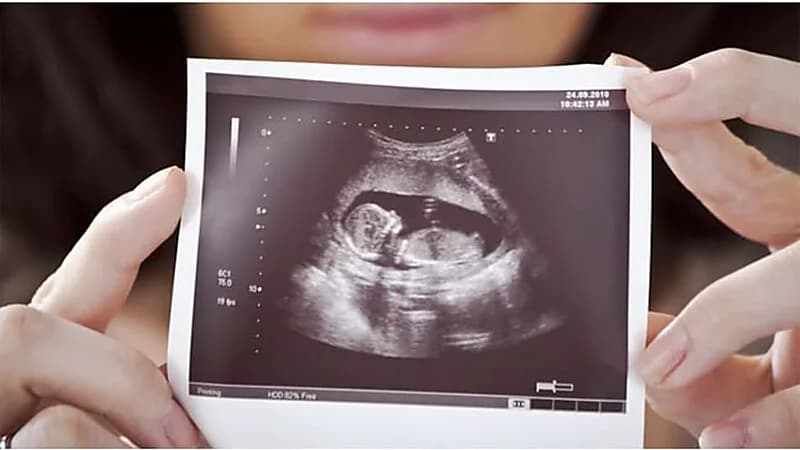 هل يمكن معرفة جنس الجنين من التغيرات الجسدية أثناء الحمل؟ استشاري يُجيب