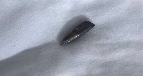 نقل " الجدوع " إلى مستشفى بالرياض بعد إخراج الرصاصة من كتفه