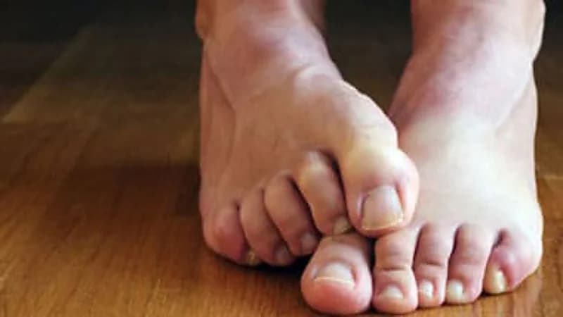 شاهد.. شخص يروي تفاصيل إصابته بجلطة بسبب المشي حافي القدمين على السيراميك