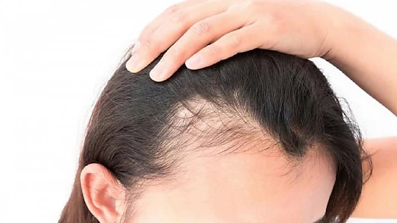 دراسة تكشف عصير طبيعي زهيد الثمن يعالج تساقط الشعر في أسبوعين
