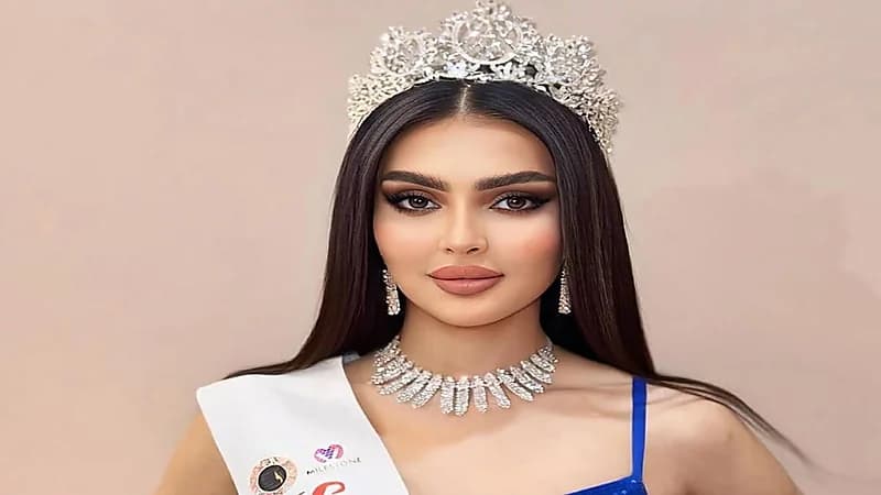 تشوه وجه ملكة جمال السعودية رومي القحطاني.. صور