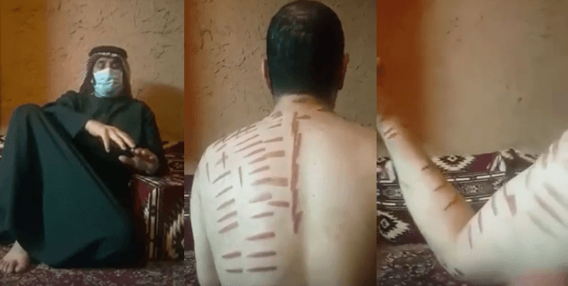 بالفيديو.. مواطن يروي معاناته مع العلاج بالكي في القصيم