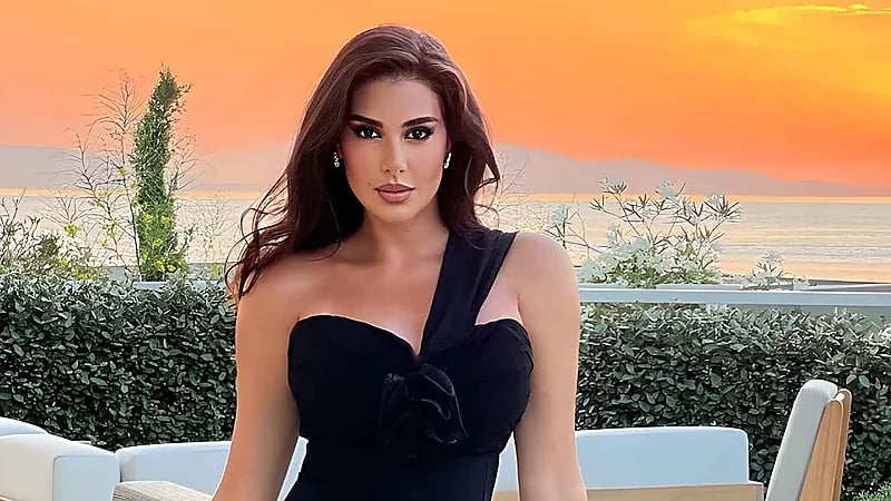 ياسمين صبري تتألق بفستان قصير وتكشف عن حروق على ساقها .. صور