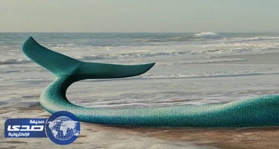 بالصور.. ولادة نادرة لطفلة سورية على شكل " عروس البحر "