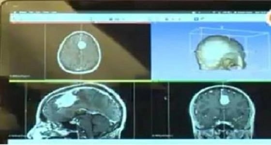 طبيب يستخدم التقنية في طباعة أعضاء من جسم الإنسان لتطوير العمليات الجراحية