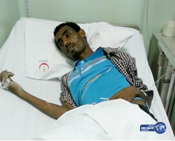 عقرب سام يُلدع عامل في قدمه