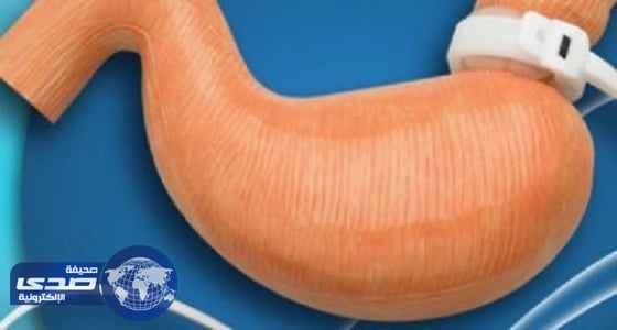 دراسة: جراحات السمنة تدمر خصوبة الرجال