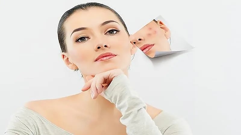 علاجات طبيعية للتخلص من البثور في البشرة