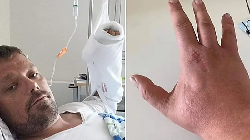 بعد سنوات من الحادثة.. عضة قطة تنهي حياة شاب