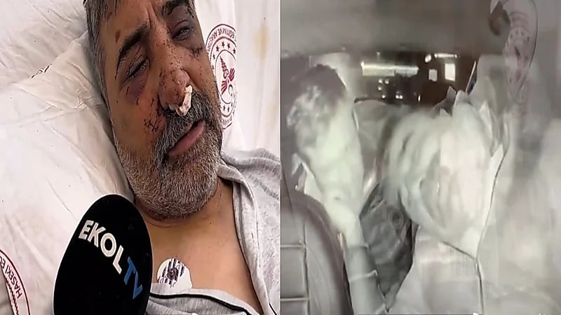 سائق تركي يتعرض للضرب والعض من ملاكم بريطاني.. فيديو