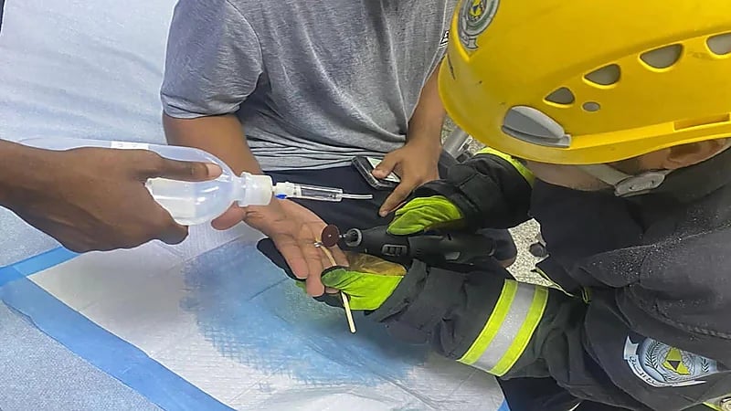 الدفاع المدني يحرر إصبع شخص علق في قطعة معدنية