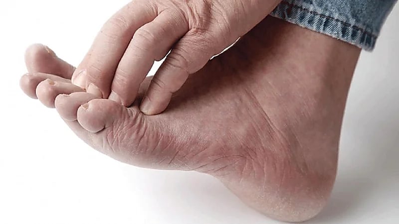 بالفيديو.. طبيبة توضح أنواع الفطريات التي تصيب القدم وأسبابها