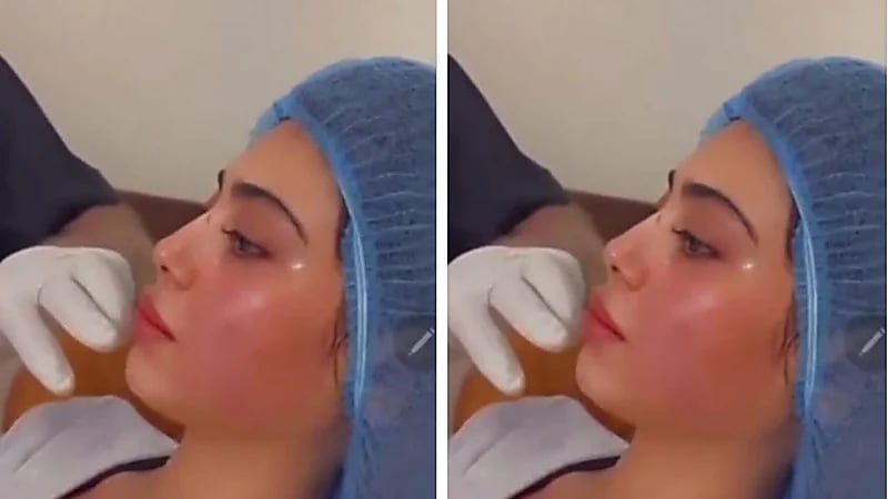 شاهد.. شيلاء سبت تجهش في البكاء داخل عيادة تجميل