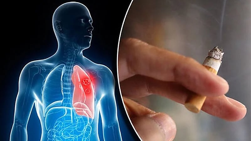 الكشف عن مدة التدخين المسببة للانسداد الرئوي المزمن