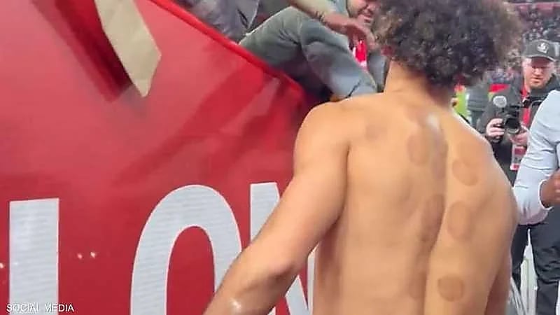 شاهد.. آثار الحجامة على ظهر محمد صلاح تلفت الأنظار