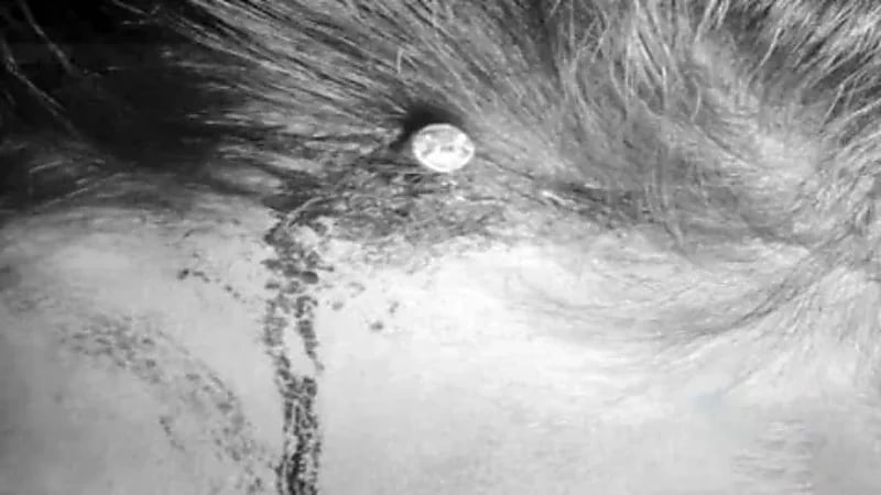 واقعة غريبة لـ "ساحر" دق مسمارًا في رأس امرأة لتحمل (صور)