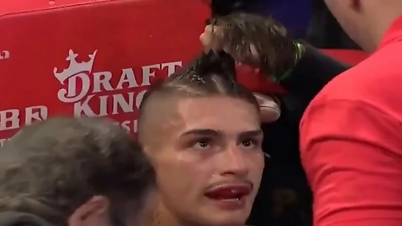 ملاكم يقص شعره المنسدل وسط المباراة .. فيديو