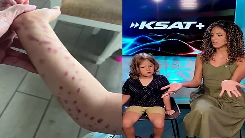 جروح خطيرة في ذراع طفل التصق أخطبوط به.. فيديو