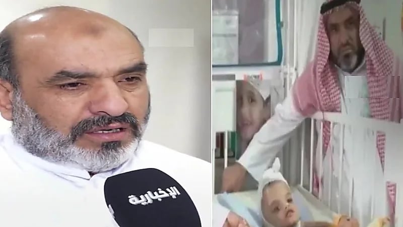 والد التوأم السيامي السوري يدعم أسرة التوأم البوركيني بعد نجاح العملية.. فيديو