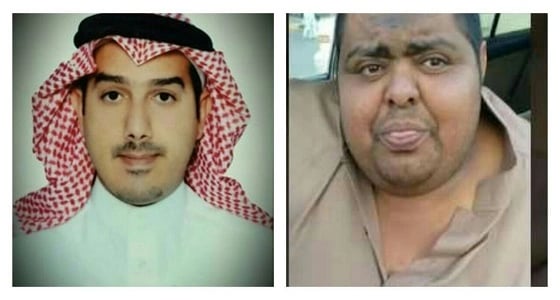 البارقي سيجري عملية التكميم بعد معاناة السمنة بمستشفى عسير