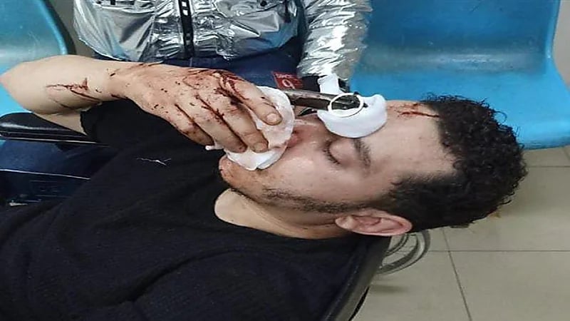 أطفال يغرسون "سكين" برأس جارهم