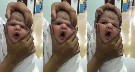 شقيقة إحدى الممرضات الموقوفات: " الأدلة على أختي غير كافية لإدانتها "