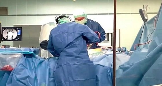 فريق طبي ينجح في استئصال حصاة لعابية لمريض