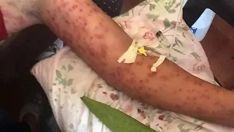 وفاة 4 أشخاص هاجمهم سرب من النحل