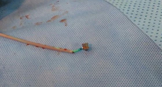 رصاصة تستقر في قلب طفل لأكثر من 24 ساعة بالمدينة