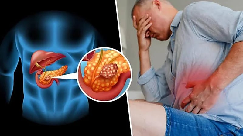 علامات تدل على الإصابة بسرطان البنكرياس