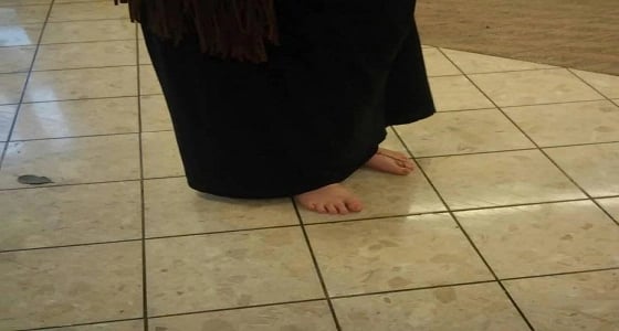 فتاة تقضي 3 سنوات حافية