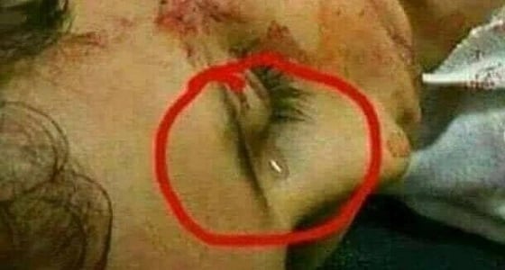 طفل العريش.. دموع في عيون بريئة أسلمت وجهها لرب العالمين