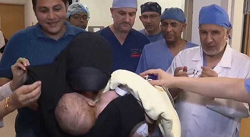 دموع وفرح بعد نجاح فصل التوأم الطفيلي المصري بوقت قياسي.. فيديو