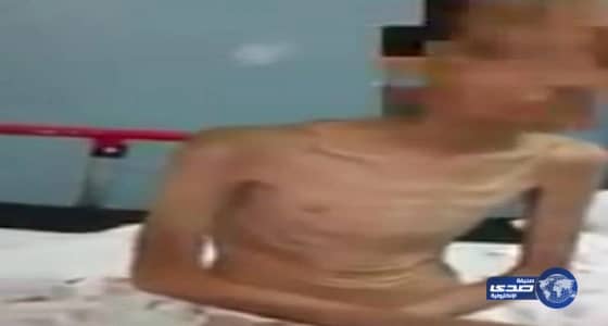 بالفيديو.. التحقيق مع الأم «المتوحشة» التي عذبت أبناءها بخيبر.. ووالدهم: مرضي السبب