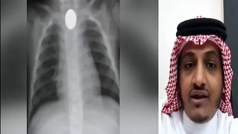 استشاري: تضاعفت نسب ابتلاع العملات الرقمية بعد تحويل العملات إلى معدنية