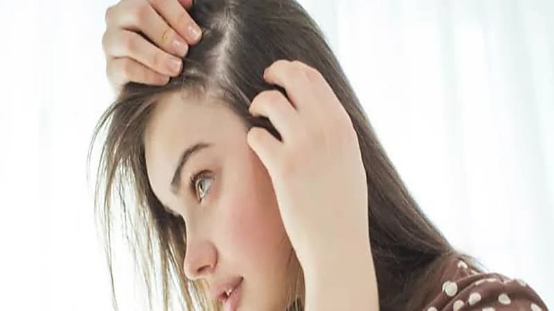 عوامل تزيد من احتمالية الإصابة بالثعلبة