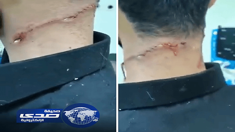 بالفيديو.. ذئب يهاجم شابًّا في حائل