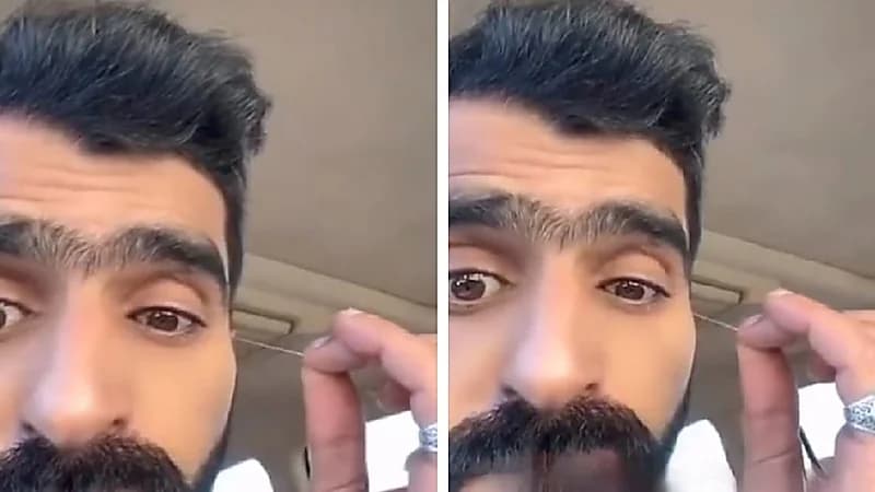 شاب يعاني من حالة غريبة تجعل الخيوط تخرج من عينه! .. فيديو