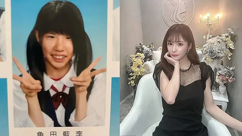 سيدة تخضع لأكثر من 20 عملية تجميل بسبب تعرضها للتنمر